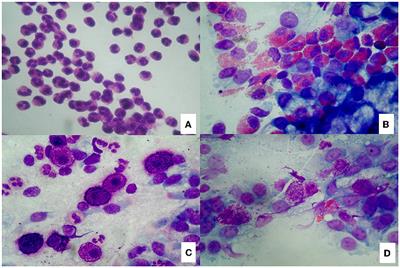 Nasal cytology and histology in CRSwNP: Two sides of the same coin